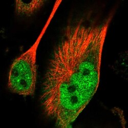 PAK7 Antibody, Novus Biologicals 25 &mu;L; Unlabeled:Antibodies, Polyclonal